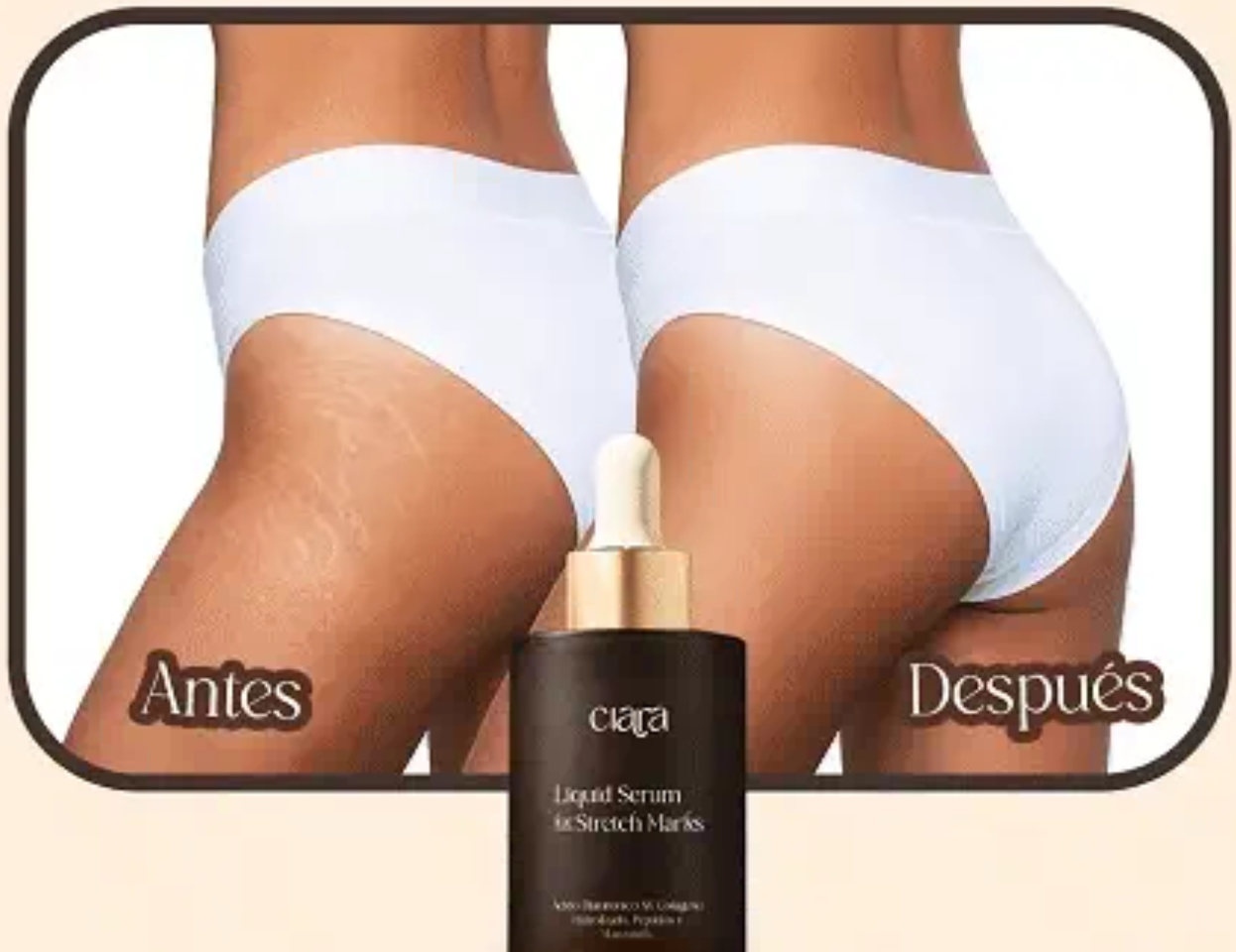 Serum anti estrias- PROMOCION POR ESTES MES✅