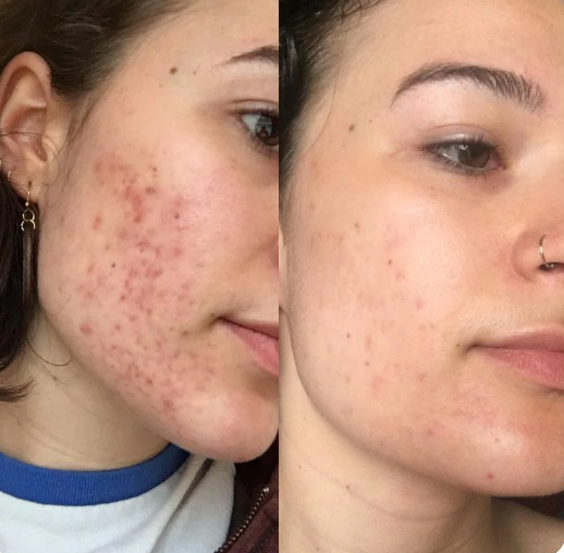 Glow Clear Kit Serum+Toallitas