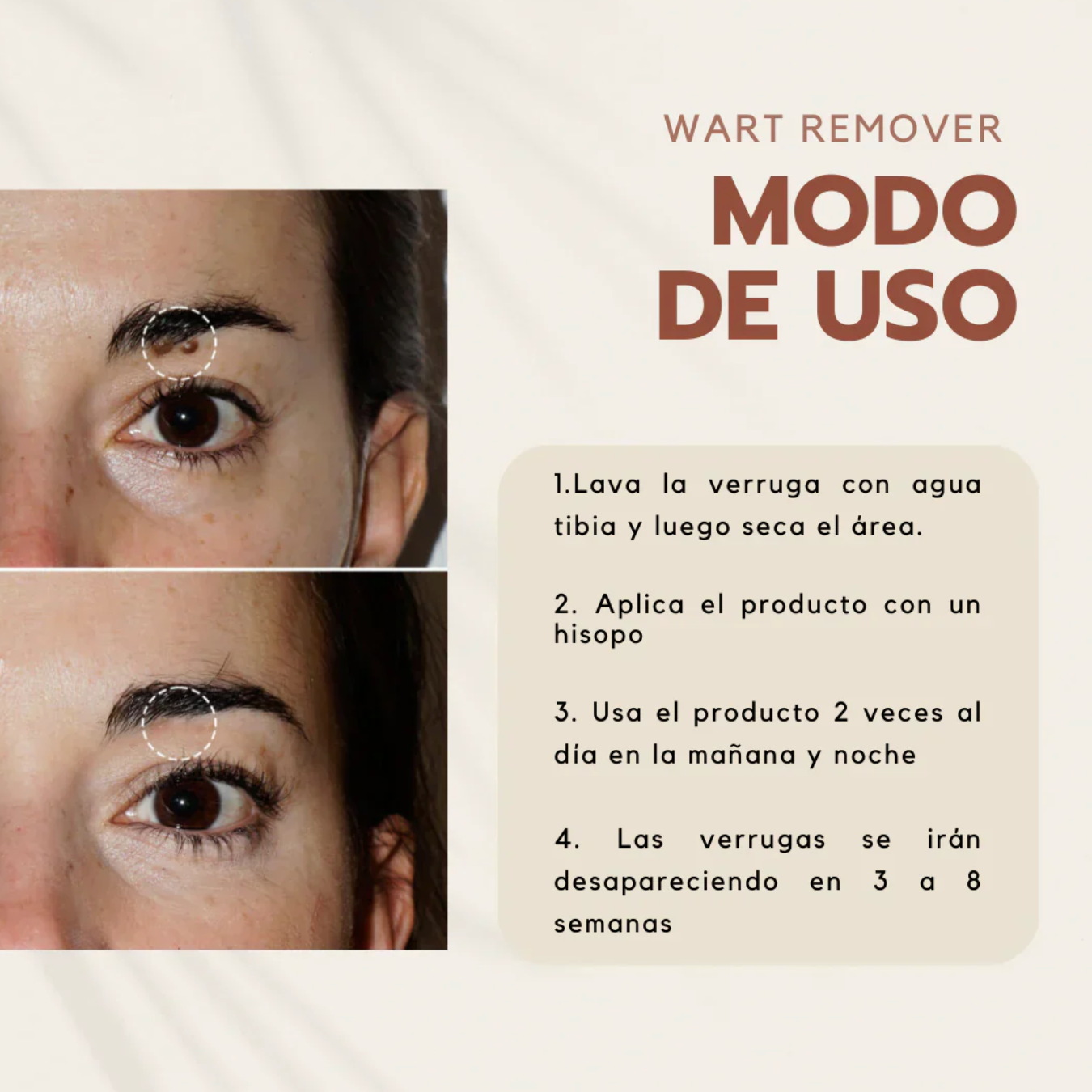 Wart Remover | Removedor de verrugas y lunares OFERTA 2X1 ✅