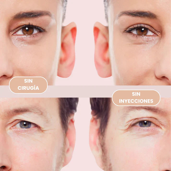 2x1 | Kit Levanta Párpados Caídos - EyeLift© PROMOCION 2X1🎁✅