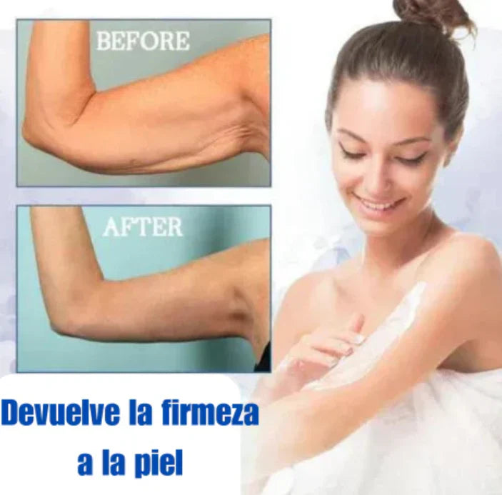 ✨🩵𝟕𝟎% 𝐎𝐅𝐅🌸𝐅𝐮𝐛𝐬𝐭𝐚® -Recupera la elasticidad de la piel⭐ 300ML