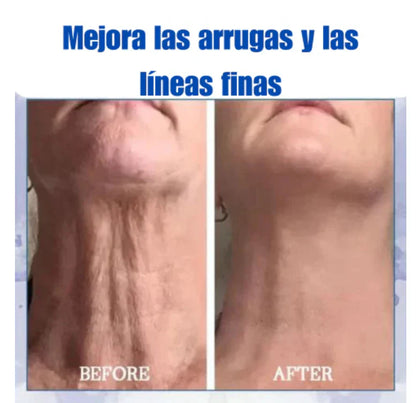 ✨🩵𝟕𝟎% 𝐎𝐅𝐅🌸𝐅𝐮𝐛𝐬𝐭𝐚® -Recupera la elasticidad de la piel⭐ 300ML