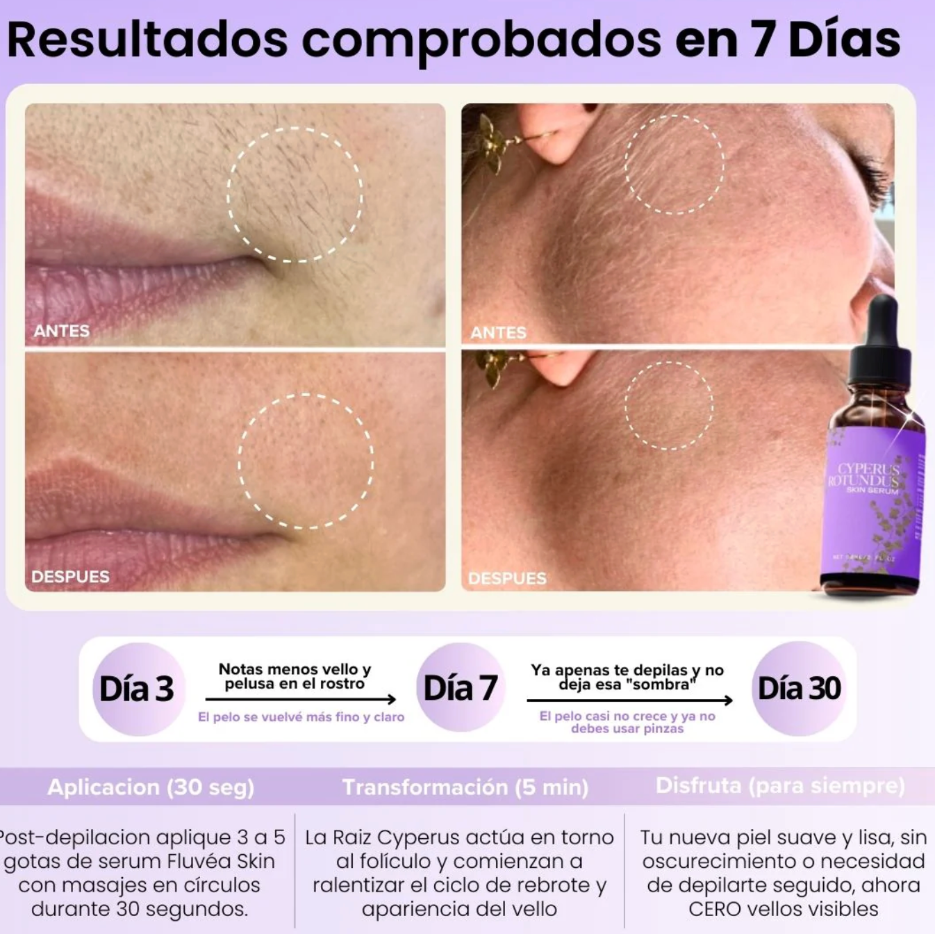 FluvéaSkin® - Vello más fino y menos visible con Raiz de Cyperus Rotundus